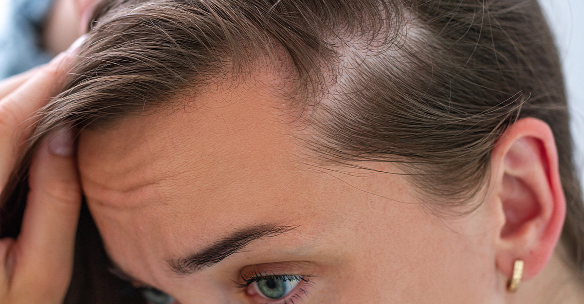What Vitamin Deficiency Causes Hair Loss?